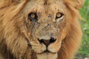 傷跡植毛の効果と施術後の注意点は？