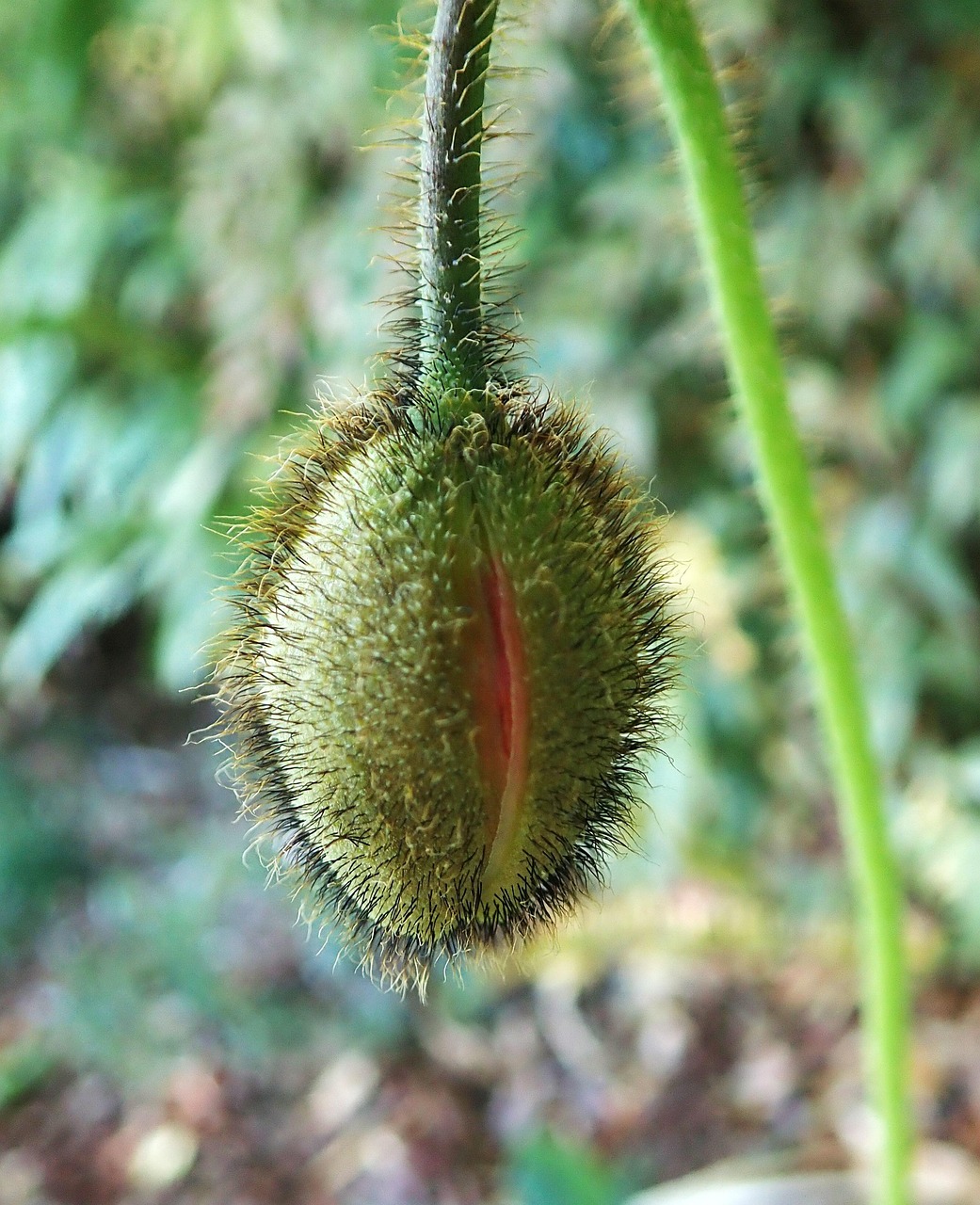 植毛を他人に勧めるべき理由とは？