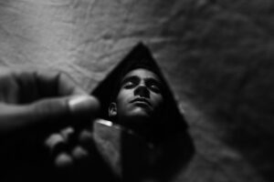 自毛植毛湘南での成功事例や体験談はどんなものがある？