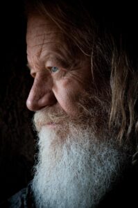 自毛植毛後のショックロスは必ず起こる？その理由と対策を解説！
